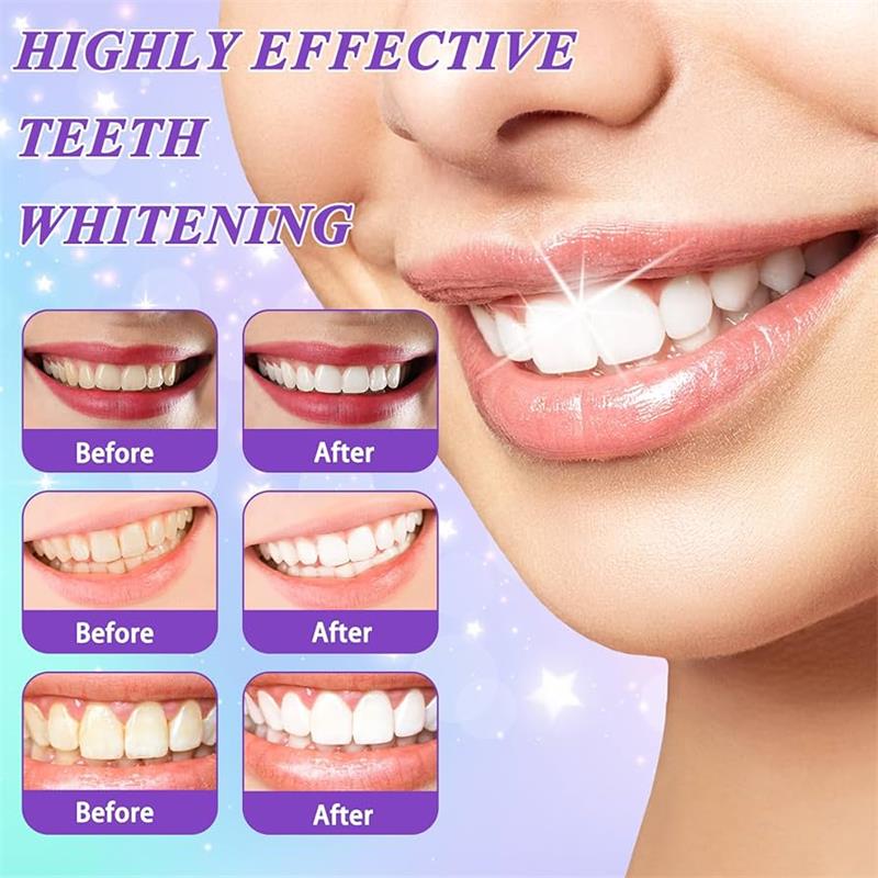 9D Lila Zahnaufhellungs-Zahnpa – Teeth Whitening Pens Bewertung und Preis