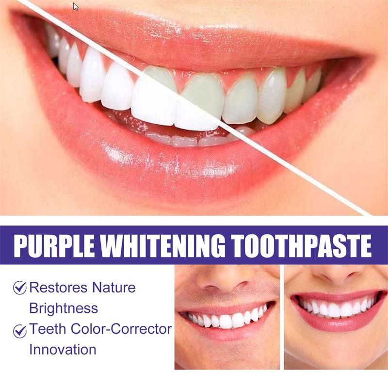9D Lila Zahnaufhellungs-Zahnpa – Teeth Whitening Pens Bewertung und Preis
