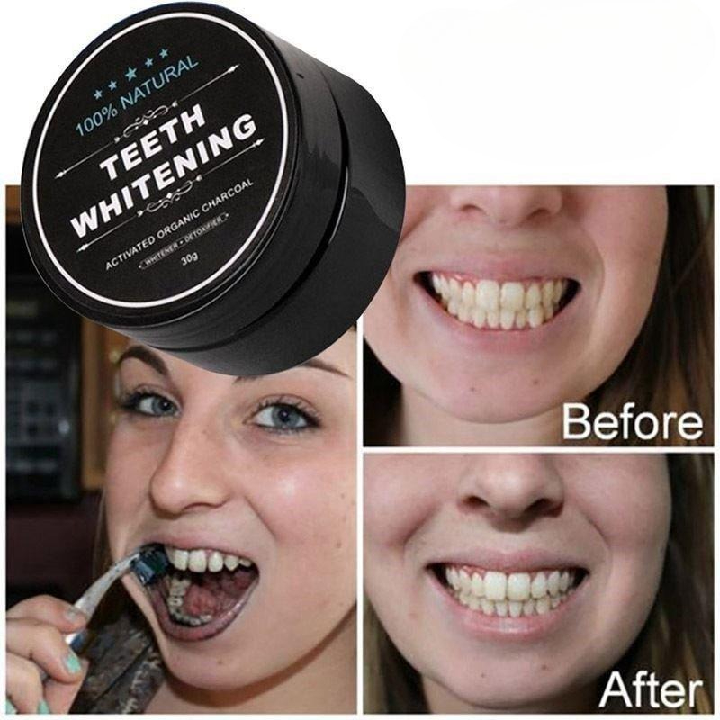 1 Box Aktivkohle-Zahnaufhellun – Teeth Whitening Pens Bewertung und Preis