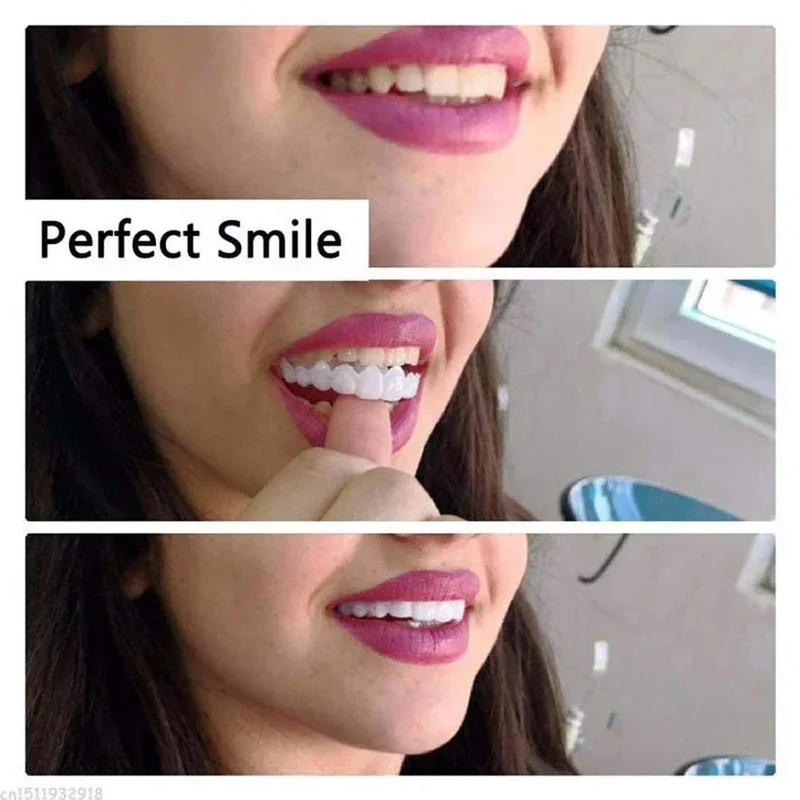 Snap-on-Furnier-Zahnsatz, vers – Teeth Whitening Kit Bewertung und Preis